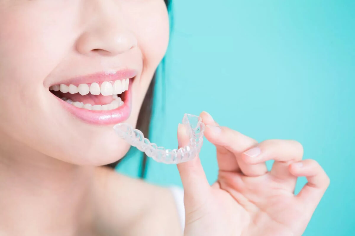 some facts you didnt know about invisalign