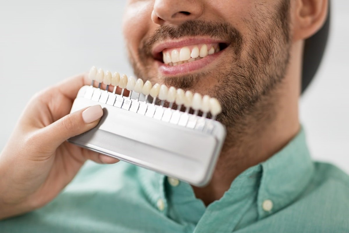 beyond hollywood how dental veneers improve everyday lives